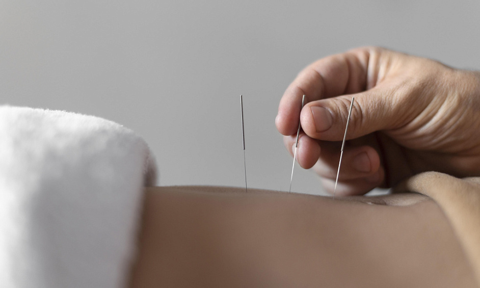 Acupuncture and Health Clinic Business for Sale Orewa, Auckland 1 Acupuncture and Health Clinic Business for Sale Orewa, Auckland 1